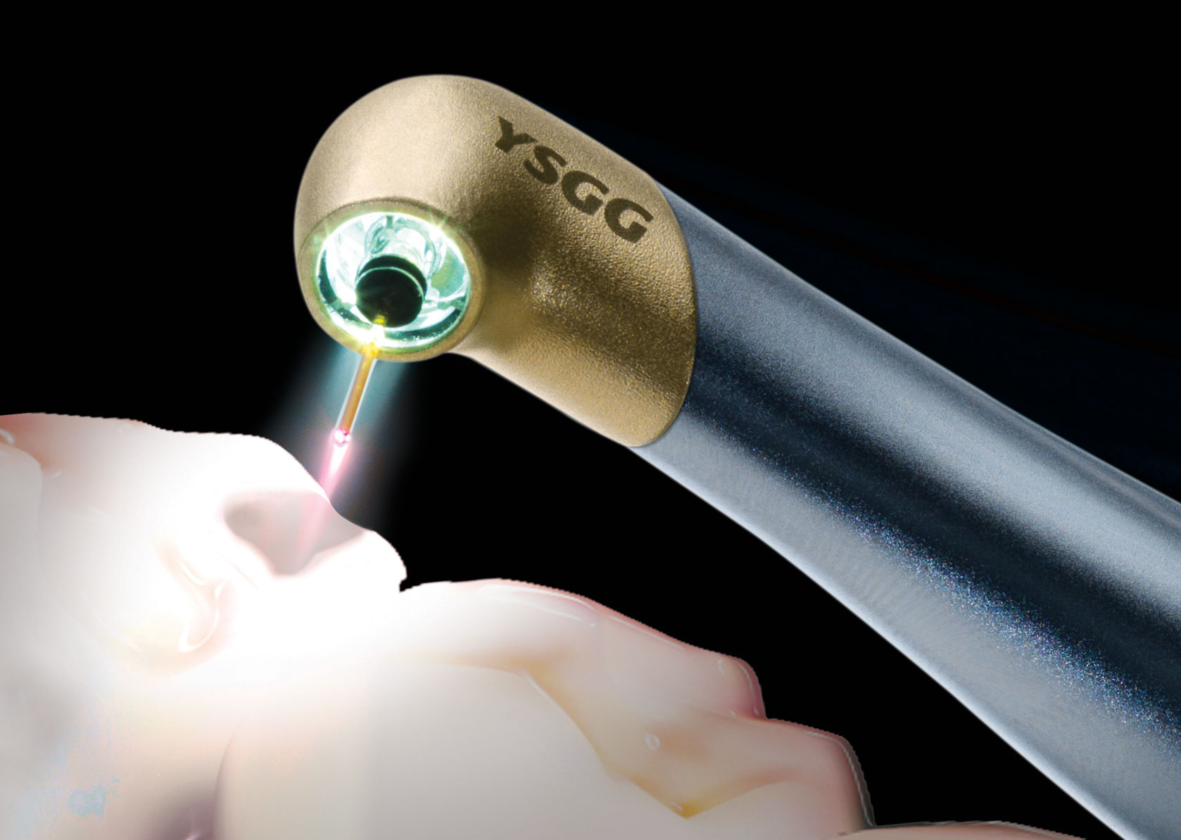 Аргоновый лазер в стоматологии